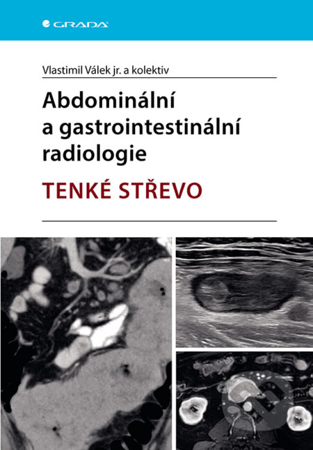 Kniha: Abdominální a gastrointestinální radiologie (Vlastimil Válek). Grada, 2025 Kniha: Abdominální a gastrointestinální radiologie (Vlastimil Válek). Grada, 2025