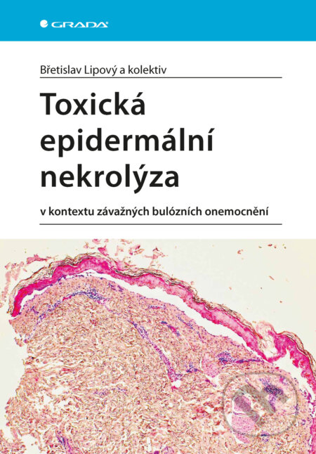 E-kniha: Toxická epidermální nekrolýza (Lipový Břetislav a kolektív). Grada, 2025 E-kniha: Toxická epidermální nekrolýza (Lipový Břetislav a kolektív). Grada, 2025