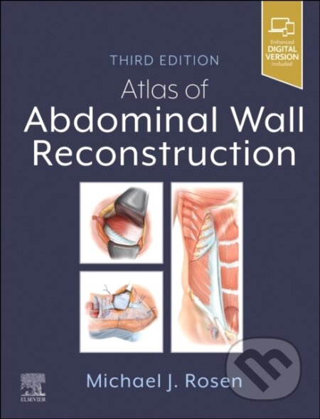Kniha: Atlas of Abdominal Wall Reconstruction (Michael J.). Churchill Livingstone, 2025 Kniha: Atlas of Abdominal Wall Reconstruction (Michael J.). Churchill Livingstone, 2025
