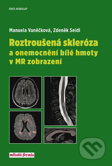 Kniha: Roztroušená skleróza a onemocnění bílé hmoty v MR zobrazení (Manuela Vaněčková a Zdeněk Seidl). Mladá fronta, 2018 Kniha: Roztroušená skleróza a onemocnění bílé hmoty v MR zobrazení (Manuela Vaněčková a Zdeněk Seidl). Mladá fronta, 2018