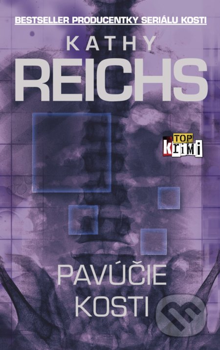 Kniha: Pavúčie kosti (Kathy Reichs). Slovart, 2018 Kniha: Pavúčie kosti (Kathy Reichs). Slovart, 2018
