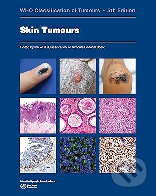 Kniha: WHO Classification of Skin Tumours (IARC). IARC, 2025 Kniha: WHO Classification of Skin Tumours (IARC). IARC, 2025