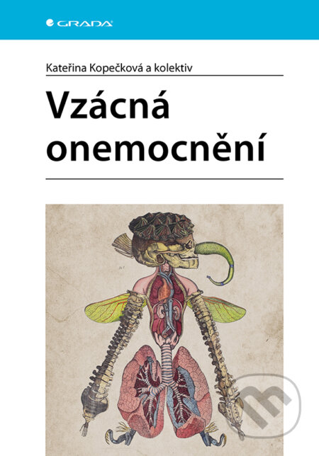 Kniha: Vzácná onemocnění (Kateřina Kopečková). Grada, 2025 Kniha: Vzácná onemocnění (Kateřina Kopečková). Grada, 2025