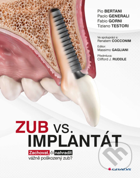 E-kniha: Zub vs. implantát (Pio Bertani, Paolo Generali, Fabio Gorni, Testori Tiziano a kolektív). Grada, 2025 E-kniha: Zub vs. implantát (Pio Bertani, Paolo Generali, Fabio Gorni, Testori Tiziano a kolektív). Grada, 2025