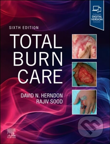 Kniha: Total Burn Care (David Herndon a Rajiv Sood). Elsevier Science, 2025 Kniha: Total Burn Care (David Herndon a Rajiv Sood). Elsevier Science, 2025