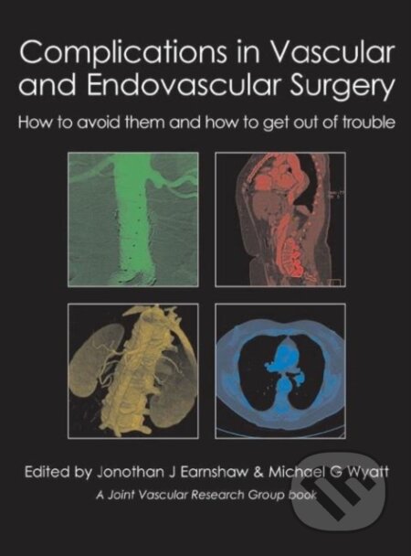 Kniha: Complications in Vascular and Endovascular Surgery (Jonathan J. Earnshaw a Michael G. Wyatt). TFM Publishing, 2012 Kniha: Complications in Vascular and Endovascular Surgery (Jonathan J. Earnshaw a Michael G. Wyatt). TFM Publishing, 2012