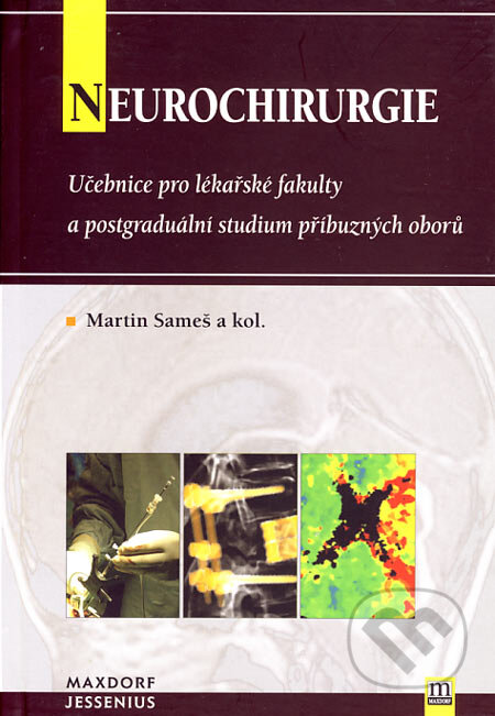 Kniha: Neurochirurgie (Martin Sameš a kolektív). Maxdorf, 2005 Kniha: Neurochirurgie (Martin Sameš a kolektív). Maxdorf, 2005