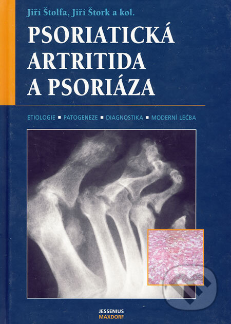 Psoriatická artritida a psoriáza - Jiří Štolfa, Jiří Štork a kol., Maxdorf, 2007