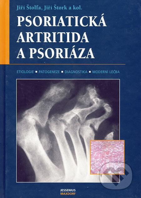 Kniha: Psoriatická artritida a psoriáza (Jiří Štolfa, Jiří Štork a kolektiv). Maxdorf, 2007 Kniha: Psoriatická artritida a psoriáza (Jiří Štolfa, Jiří Štork a kolektiv). Maxdorf, 2007