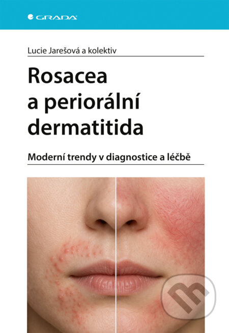Kniha: Rosacea a periorální dermatitida (Lucie Jarešová). Grada, 2026 Kniha: Rosacea a periorální dermatitida (Lucie Jarešová). Grada, 2026
