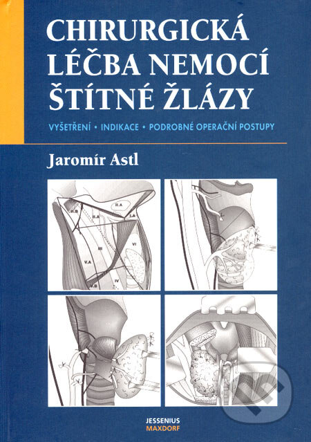 Kniha: Chirurgická léčba nemocí štítné žlázy (Jaromír Astl). Maxdorf, 2007 Kniha: Chirurgická léčba nemocí štítné žlázy (Jaromír Astl). Maxdorf, 2007