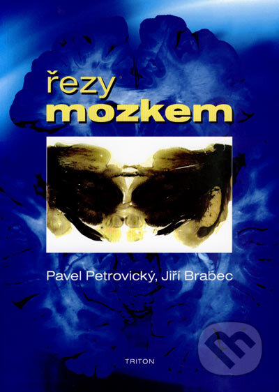 Kniha: Řezy mozkem (Jiří Brabec a Pavel Petrovický). Triton, 2007 Kniha: Řezy mozkem (Jiří Brabec a Pavel Petrovický). Triton, 2007