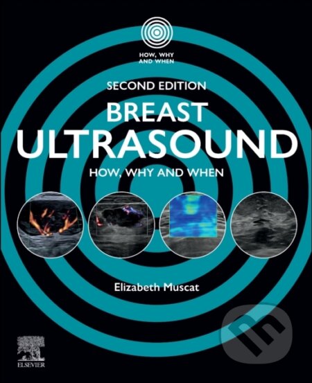Kniha: Breast Ultrasound, 2nd Edition (Muscat). Elsevier Science, 2026 Kniha: Breast Ultrasound, 2nd Edition (Muscat). Elsevier Science, 2026
