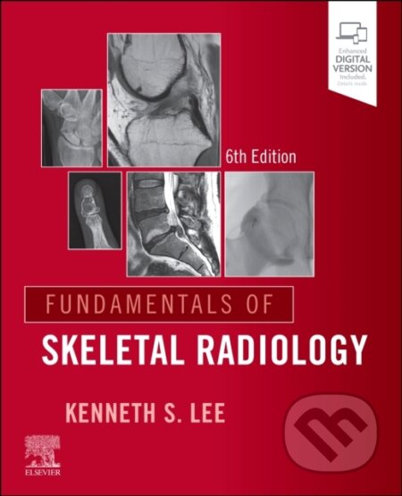 Kniha: Fundamentals of Skeletal Radiology (Kenneth S. a MD Lee). Churchill Livingstone, 2026 Kniha: Fundamentals of Skeletal Radiology (Kenneth S. a MD Lee). Churchill Livingstone, 2026