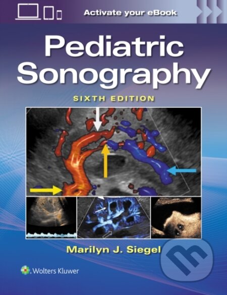 Kniha: Pediatric Sonography (MARILYN JOY SIEGEL). Wolters Kluwer Health, 2026 Kniha: Pediatric Sonography (MARILYN JOY SIEGEL). Wolters Kluwer Health, 2026