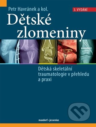 Kniha: Dětské zlomeniny, 3. vydání (Petr Havránek a kolektiv). Maxdorf, 2026 Kniha: Dětské zlomeniny, 3. vydání (Petr Havránek a kolektiv). Maxdorf, 2026