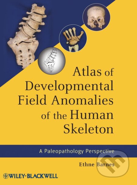 Kniha: Atlas of Developmental Field Anomalies of the Human Skeleton (Ethne Barnes). Wiley-Blackwell, 2012 Kniha: Atlas of Developmental Field Anomalies of the Human Skeleton (Ethne Barnes). Wiley-Blackwell, 2012