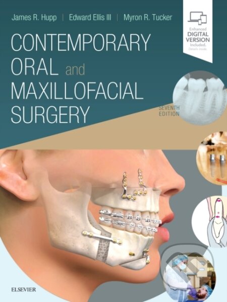 Kniha: Contemporary Oral and Maxillofacial Surgery (Edward, DDS, MS Ellis, Myron R., DDS Tucker, James R., DMD, MD, JD a MBA Hupp). Mosby, 2018 Kniha: Contemporary Oral and Maxillofacial Surgery (Edward, DDS, MS Ellis, Myron R., DDS Tucker, James R., DMD, MD, JD a MBA Hupp). Mosby, 2018