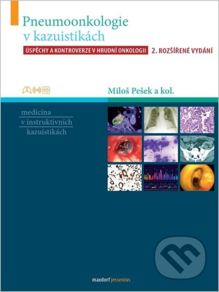 Kniha: Pneumoonkologie v kazuistikách - Úspěchy a kontroverze v hrudní chirurgii (Miloš Pešek). Maxdorf, 2026 Kniha: Pneumoonkologie v kazuistikách - Úspěchy a kontroverze v hrudní chirurgii (Miloš Pešek). Maxdorf, 2026