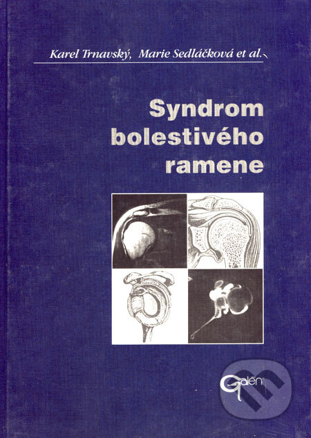 Kniha: Syndrom bolestivého ramene (Karel Trnavský a Marie Sedláčková). Galén, 2002 Kniha: Syndrom bolestivého ramene (Karel Trnavský a Marie Sedláčková). Galén, 2002