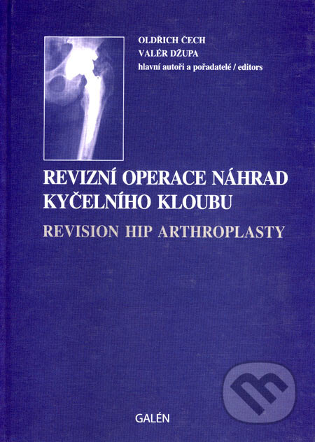 Kniha: Revizní operace náhrad kyčelního kloubu (Oldřich Čech a Valér Džupa). Galén, 2004 Kniha: Revizní operace náhrad kyčelního kloubu (Oldřich Čech a Valér Džupa). Galén, 2004