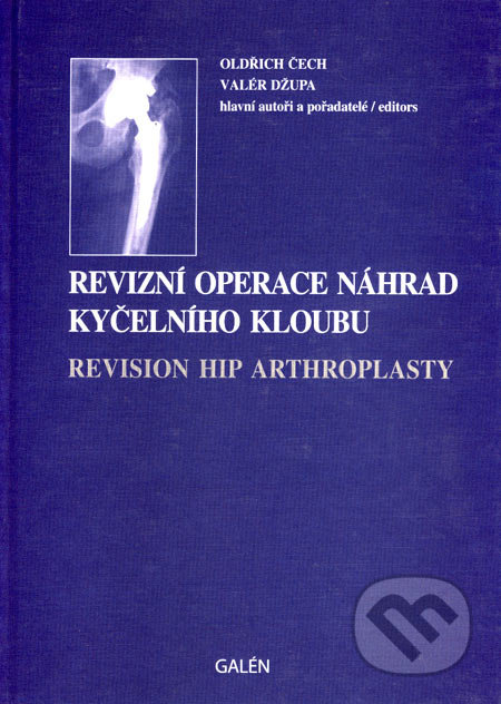 Revizní operace náhrad kyčelního kloubu - Oldřich Čech, Valér Džupa, Galén, 2004