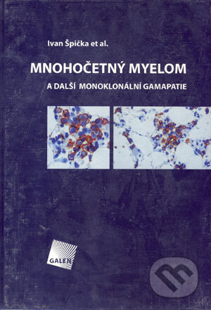 Kniha: Mnohočetný myelom (Ivan Špička et al.). Galén, 2005 Kniha: Mnohočetný myelom (Ivan Špička et al.). Galén, 2005