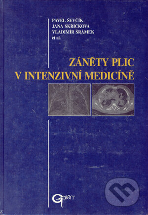 Kniha: Záněty plic v intenzivní medicíně (Jana Skřičková, Pavel Ševčík, Vladimír Šrámek a kolektiv). Galén, 2004 Kniha: Záněty plic v intenzivní medicíně (Jana Skřičková, Pavel Ševčík, Vladimír Šrámek a kolektiv). Galén, 2004