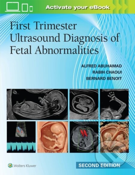 Kniha: First Trimester Ultrasound Diagnosis of Fetal Abnormalities (Alfred Z. Abuhamad, RABIH CHAOUI a Bernard Benoit). Wolters Kluwer Health, 2026 Kniha: First Trimester Ultrasound Diagnosis of Fetal Abnormalities (Alfred Z. Abuhamad, RABIH CHAOUI a Bernard Benoit). Wolters Kluwer Health, 2026
