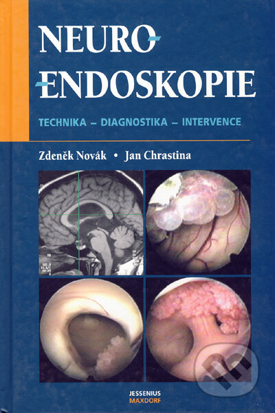 Kniha: Neuroendoskopie (Jan Chrastina a Zdeněk Novák). Maxdorf, 2005 Kniha: Neuroendoskopie (Jan Chrastina a Zdeněk Novák). Maxdorf, 2005