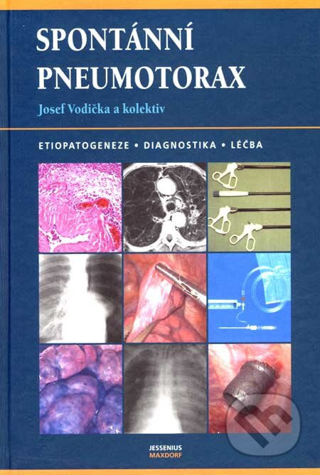 Kniha: Spontánní pneumotorax (Josef Vodička a kolektív). Maxdorf, 2007 Kniha: Spontánní pneumotorax (Josef Vodička a kolektív). Maxdorf, 2007