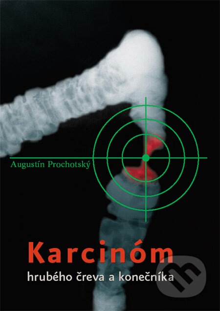 Kniha: Karcinóm hrubého čreva a konečníka (Augustín Prochotský). Litera Medica, 2006 Kniha: Karcinóm hrubého čreva a konečníka (Augustín Prochotský). Litera Medica, 2006