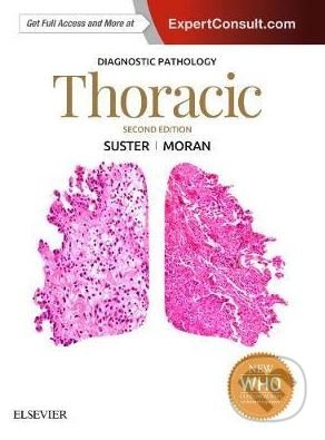 Kniha: Diagnostic Pathology: Thoracic (Cesar A. Moran a Saul Suster). Elsevier Science, 2017 Kniha: Diagnostic Pathology: Thoracic (Cesar A. Moran a Saul Suster). Elsevier Science, 2017