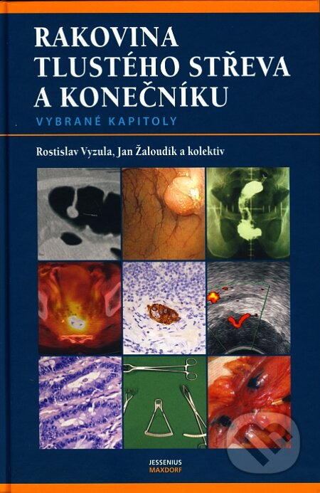 Kniha: Rakovina tlustého střeva a konečníku (Jan Žaloudík a Rostislav Vyzula). Maxdorf, 2007 Kniha: Rakovina tlustého střeva a konečníku (Jan Žaloudík a Rostislav Vyzula). Maxdorf, 2007