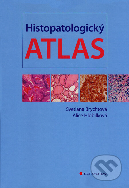 Kniha: Histopatologický atlas (Alice Hlobilková a Svetlana Brychtová). Grada, 2008 Kniha: Histopatologický atlas (Alice Hlobilková a Svetlana Brychtová). Grada, 2008
