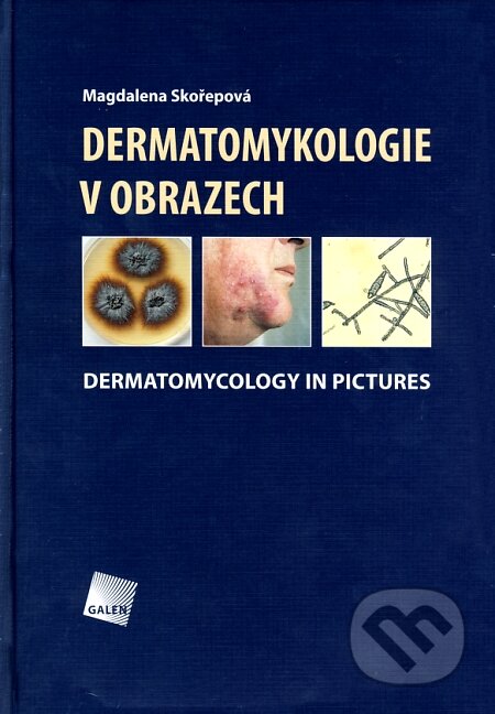 Kniha: Dermatomykologie v obrazech (Magdalena Skořepová). Galén, 2008 Kniha: Dermatomykologie v obrazech (Magdalena Skořepová). Galén, 2008