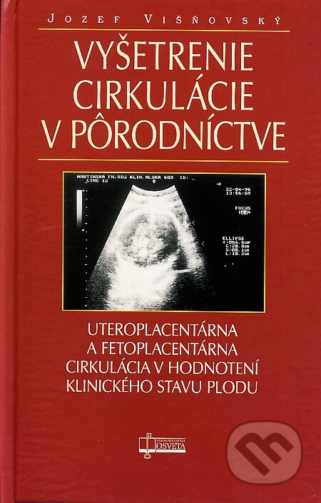 Kniha: Vyšetrenie cirkulácie v pôrodníctve (Jozef Višňovský). Osveta, 2002 Kniha: Vyšetrenie cirkulácie v pôrodníctve (Jozef Višňovský). Osveta, 2002