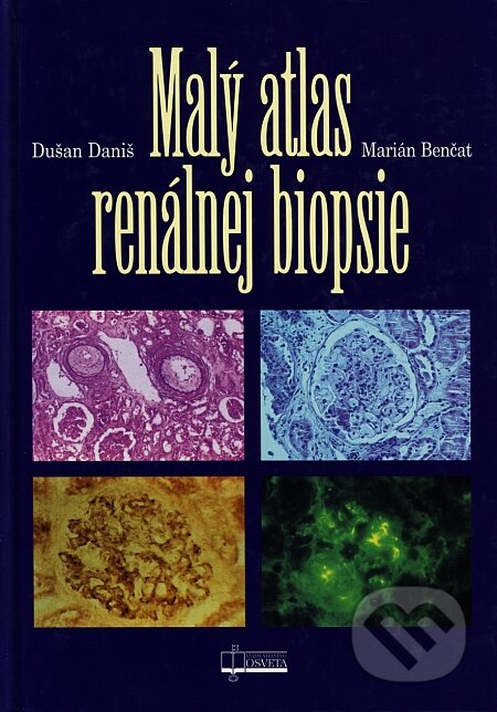 Kniha: Malý atlas renálnej biopsie (Dušan Daniš a Marián Benčat). Osveta, 2000 Kniha: Malý atlas renálnej biopsie (Dušan Daniš a Marián Benčat). Osveta, 2000