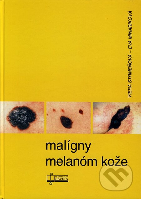 Kniha: Malígny melanóm kože (Eva Minariková a Viera Strmeňová). Osveta, 2005 Kniha: Malígny melanóm kože (Eva Minariková a Viera Strmeňová). Osveta, 2005