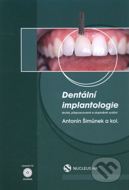 Kniha: Dentální implantologie (Antotnín Šimůnek a kolektív). Nucleus HK, 2008 Kniha: Dentální implantologie (Antotnín Šimůnek a kolektív). Nucleus HK, 2008