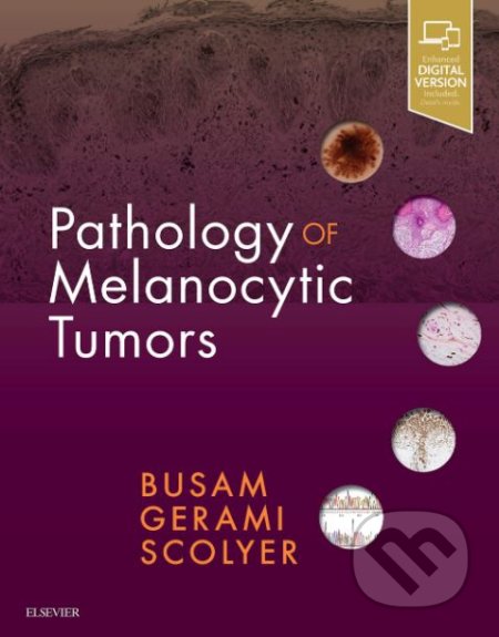 Kniha: Pathology of Melanocytic Tumors (Klaus J. Busam, Pedram Gerami a Richard A. Scolyer). Elsevier Science, 2018 Kniha: Pathology of Melanocytic Tumors (Klaus J. Busam, Pedram Gerami a Richard A. Scolyer). Elsevier Science, 2018