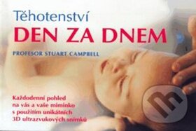 Kniha: Těhotenství den za dnem (Fortuna Libri ČR). Fortuna Libri ČR, 2008 Kniha: Těhotenství den za dnem (Fortuna Libri ČR). Fortuna Libri ČR, 2008