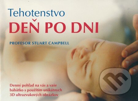 Kniha: Tehotenstvo deň po dni (Stuart Campbell). Fortuna Print, 2008 Kniha: Tehotenstvo deň po dni (Stuart Campbell). Fortuna Print, 2008