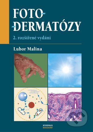 Kniha: Fotodermatózy (Lubor Malina). Maxdorf, 2004 Kniha: Fotodermatózy (Lubor Malina). Maxdorf, 2004