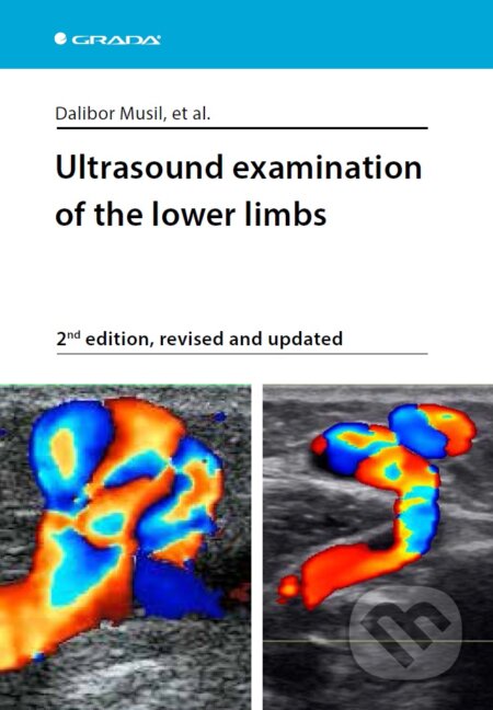 Ultrasound examination of the lower limbs - Musil Dalibor a kolektiv, Grada, 2019
