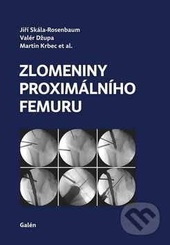 Kniha: Zlomeniny proximálního femuru (Jiří Skála-Rosenbaum, Martin Krbec a Valér Džupa). Galén, 2019 Kniha: Zlomeniny proximálního femuru (Jiří Skála-Rosenbaum, Martin Krbec a Valér Džupa). Galén, 2019