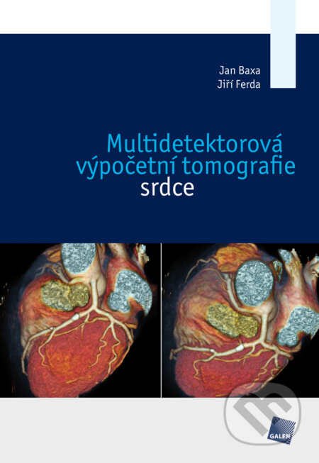 E-kniha: Multidetektorová výpočetní tomografie srdce (Jan Baxa a Jiří Ferda). Galén, 2012 E-kniha: Multidetektorová výpočetní tomografie srdce (Jan Baxa a Jiří Ferda). Galén, 2012