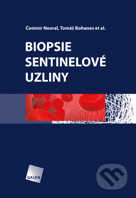E-kniha: Biopsie sentinelové uzliny (Čestmír Neoral, Tomáš Bohanes a kolektív). Galén, 2012 E-kniha: Biopsie sentinelové uzliny (Čestmír Neoral, Tomáš Bohanes a kolektív). Galén, 2012