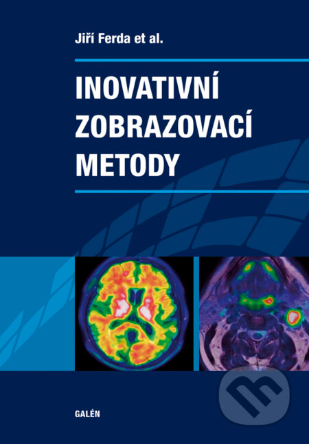 E-kniha: Inovativní zobrazovací metody (Jiří Ferda). Galén, 2015 E-kniha: Inovativní zobrazovací metody (Jiří Ferda). Galén, 2015