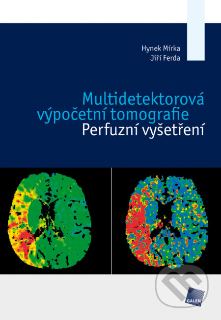 Multidetektorová výpočetní tomografie - Hynek Mírka, Jiří Ferda, Galén, 2015